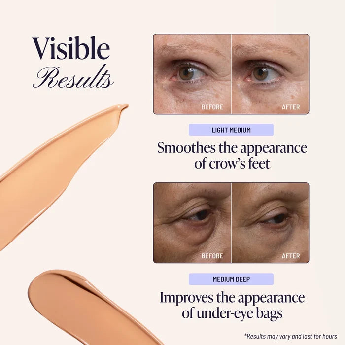 60 Second Eye Effects visible results before and after