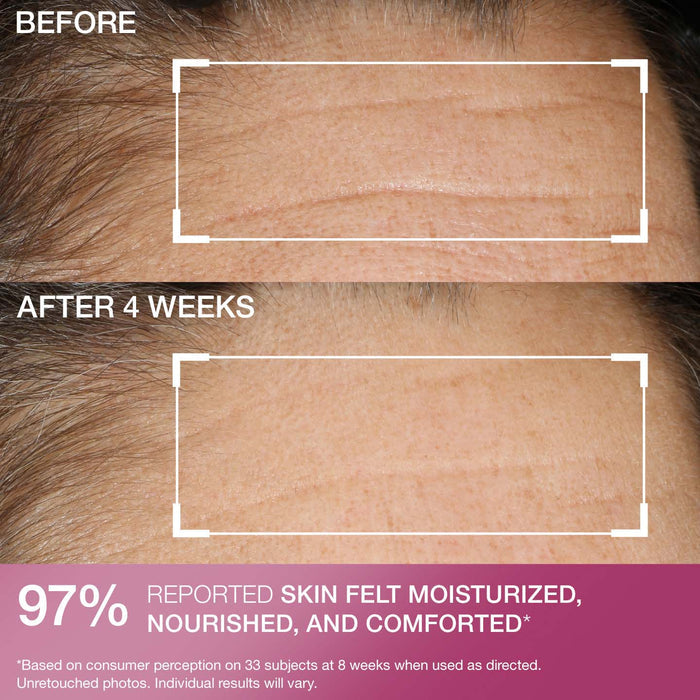 Advanced Retinol Nightly Renewal Moisturizer