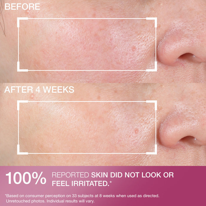 Advanced Retinol Nightly Renewal Moisturizer