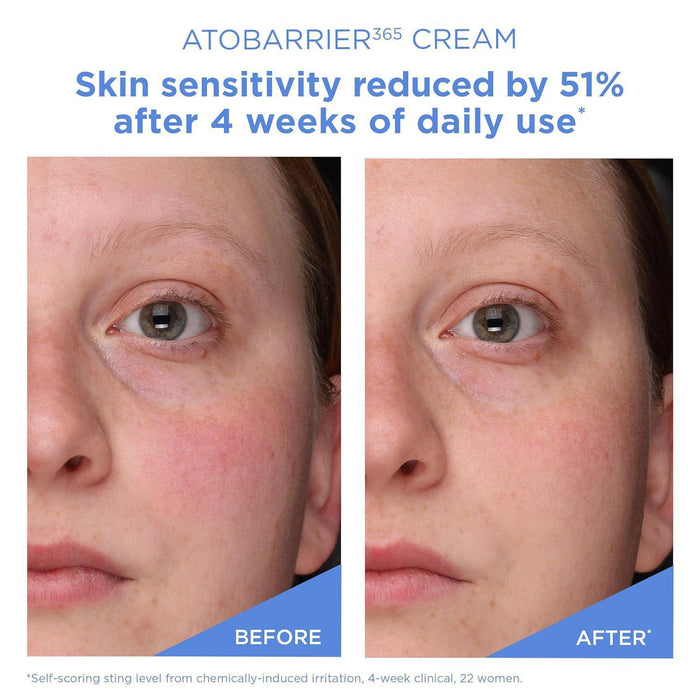 Aestura AtoBarrier 365 Cream 80 mL
