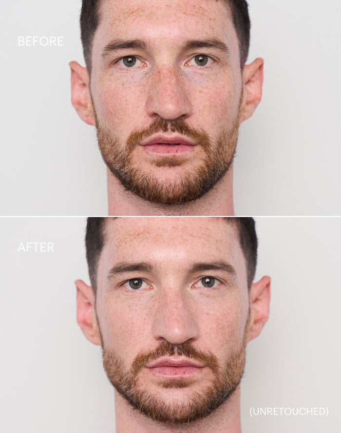 concealer-stick-spf-20; light-to-medium: Before & After der Shade Light to Medium