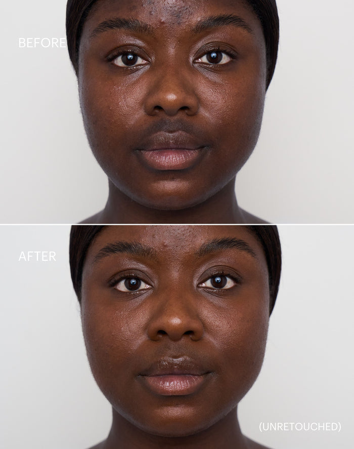concealer-stick-spf-20; deep-1: Before & After der Shade Deep 1