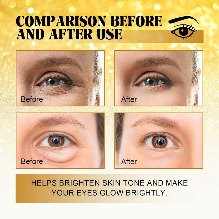 EELHOE 24K Gold Eye mask Moisturizing And Improving 60pcs EELHOE COSMETICS