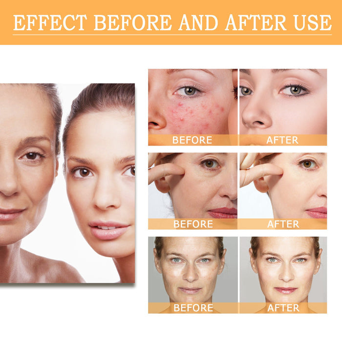 EELHOE Glycolic Acid 7% Toning Lotion Remove skin cutin & acne EELHOE COSMETICS