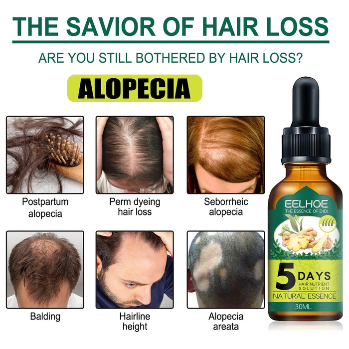 EELHOE Hair oil regrowth Ginger Essential Oil for Alopecia and Hair Loss (30ml) EELHOE COSMETICS