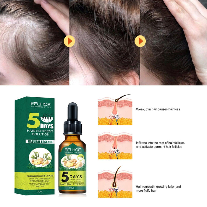 EELHOE Hair oil regrowth Ginger Essential Oil for Alopecia and Hair Loss (30ml) EELHOE COSMETICS