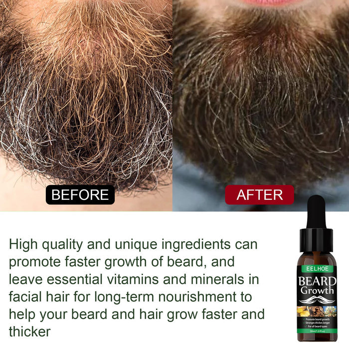 EELHOE Mens Best Beard Oil Mist Intensive Treatment Oil EELHOE COSMETICS