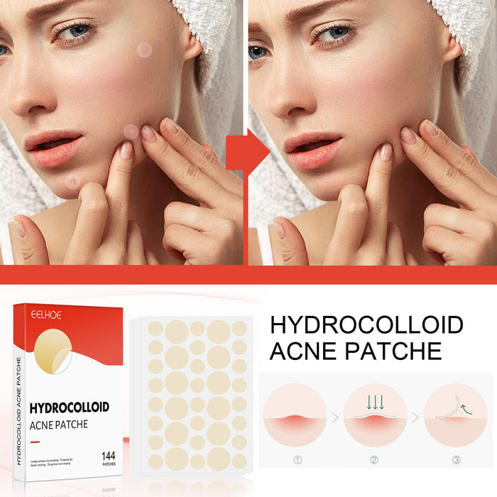 Eelhoe Patch Invisible Hydrocolloid Anti Acne for Makeup 144pcs EELHOE COSMETICS