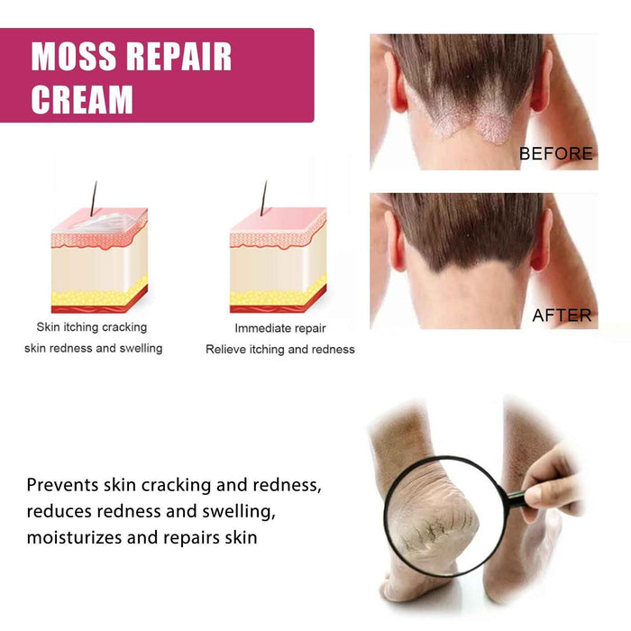 EELHOE Repair Cream Relieve Itching Body , Hands And Feet 50g EELHOE COSMETICS