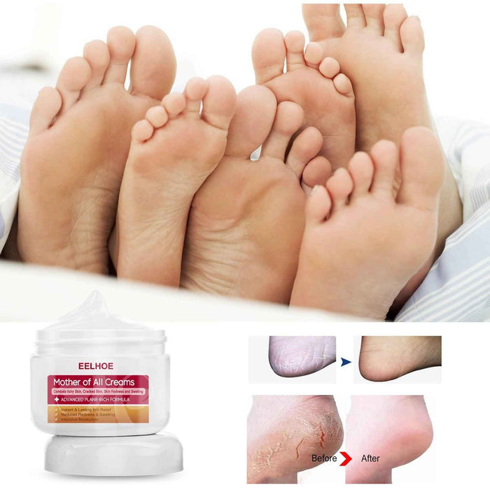 EELHOE Repair Cream Relieve Itching Body , Hands And Feet 50g EELHOE COSMETICS