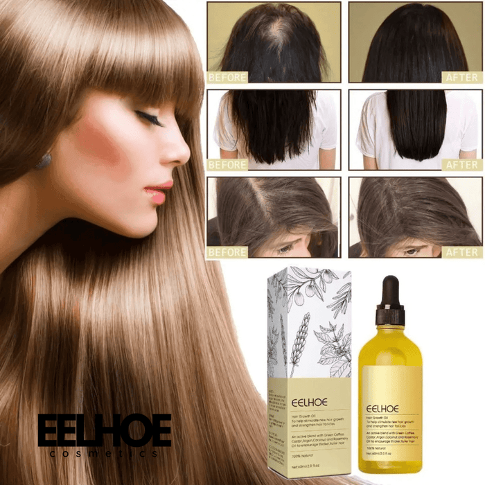 EELHOE Rosemary Essential Oil for Hair Growth – Nourishing & Strengthening EELHOE COSMETICS