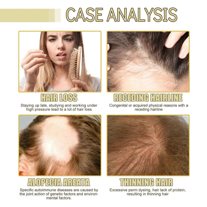 EELHOE Rosemary Essential Oil for Hair Growth – Nourishing & Strengthening EELHOE COSMETICS