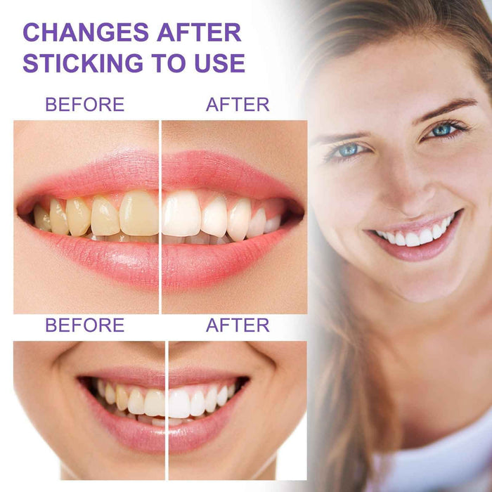 EELHOE Teeth Whitening V34 EELHOE COSMETICS