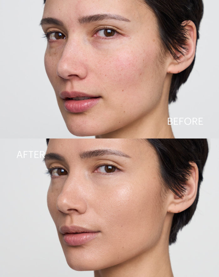 cc-cream-spf-30; medium: Before & After der CC Cream in Medium