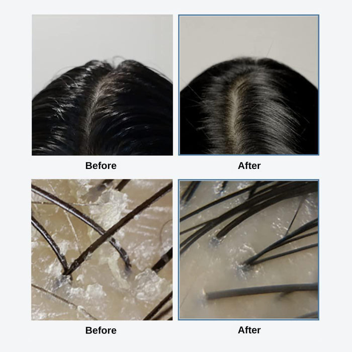 Growus Sea Salt Therapy Scalp Scaler 250 g