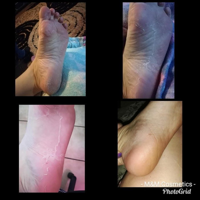 Magdala Skincare - Repair Heel Balm Treatment
