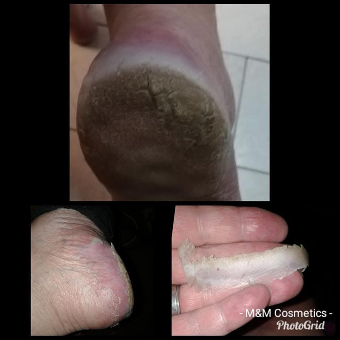 Magdala Skincare - Repair Heel Balm Treatment