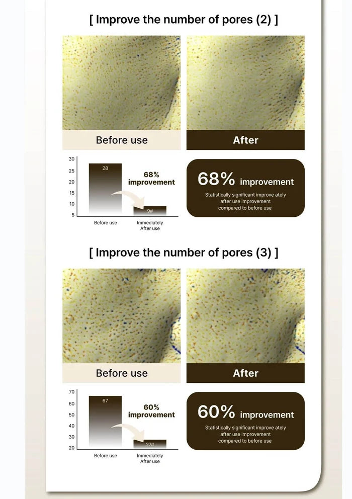 Before and after comparison of skin texture improvement with statistical data on a white background