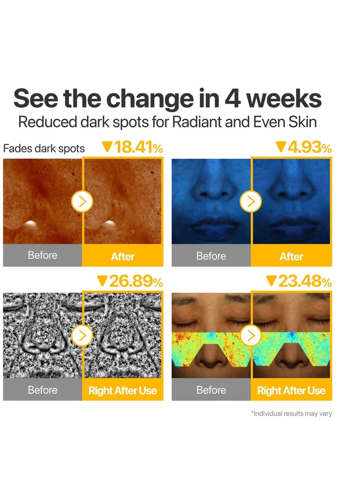 Before and after effects of a skincare product on skin with dark spots, shown over 4 weeks.