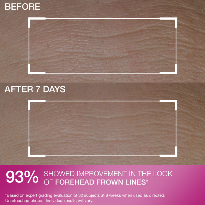 Peptide Plump® Line Filling Bounce Serum