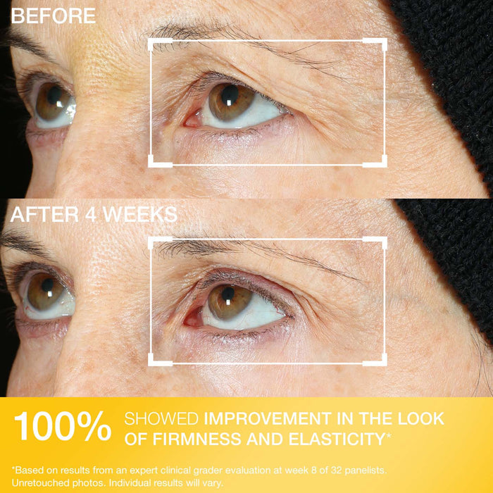 Peptight® 360˚ Tightening Eye Serum
