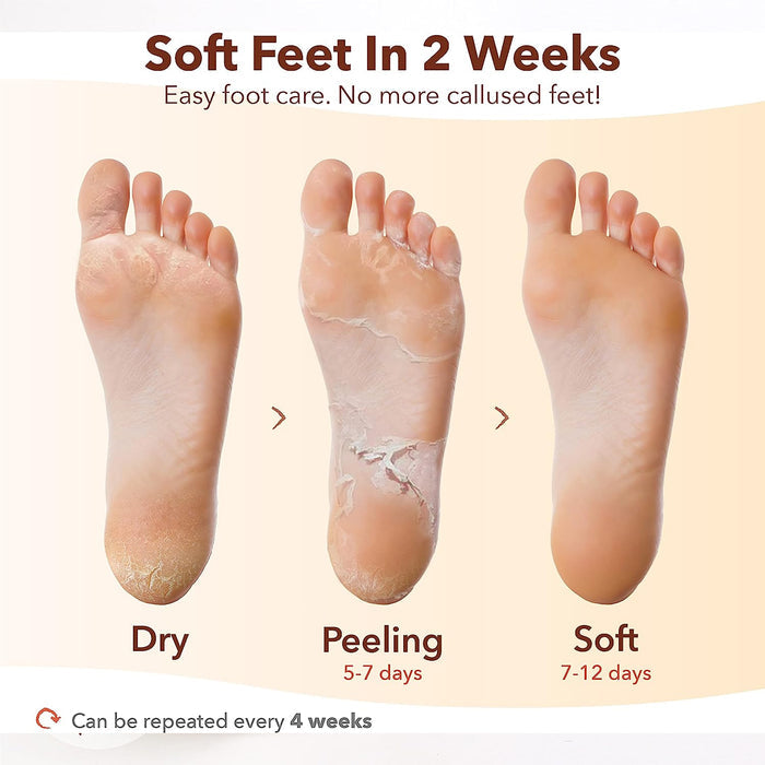 PUREDERM-Exfoliating Foot mask