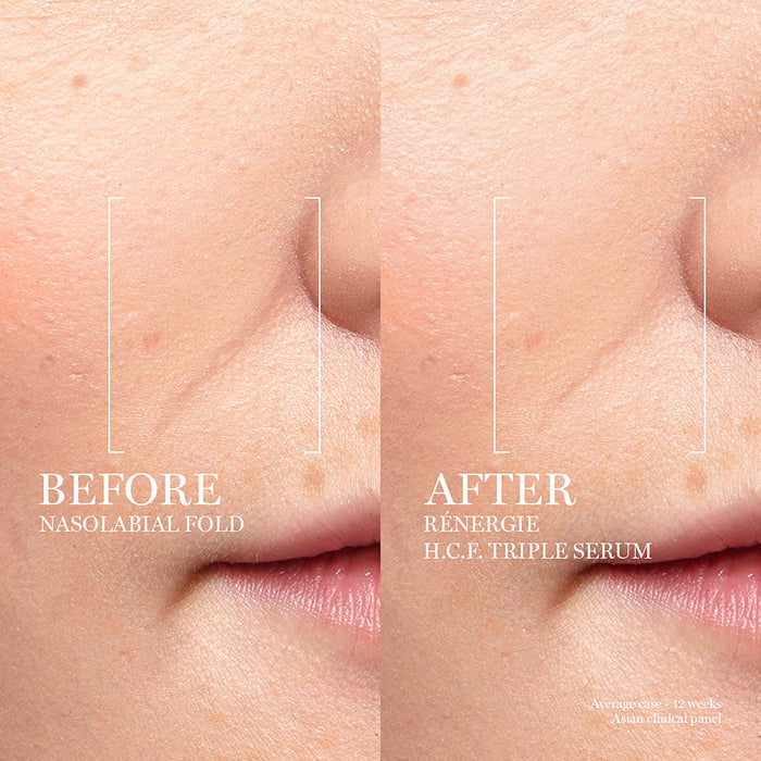 Rénergie H.C.F. Triple Serum 50ml