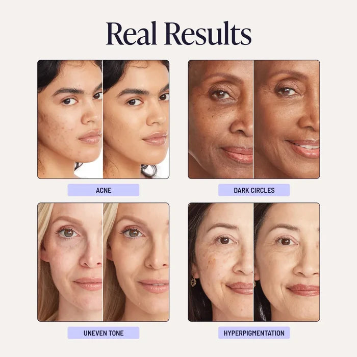 Supreme Creme conceals skin imperfections