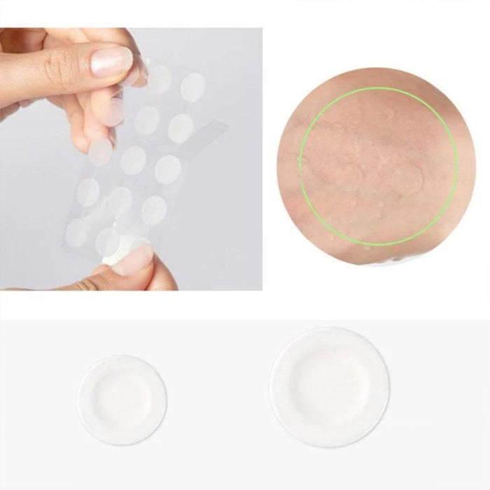 VT COSMETICS Spot Patch 48 patches
