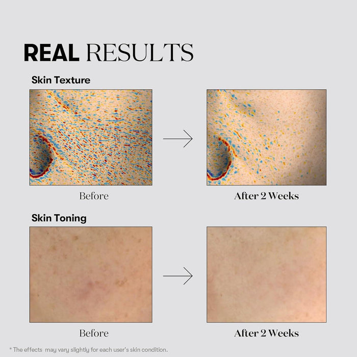 VT COSMETICS TX-Toning Essence 1000 Shot 30 mL